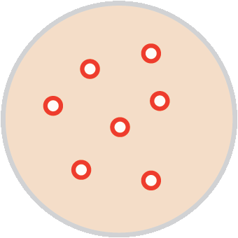 congestion-bumps-whiteheads