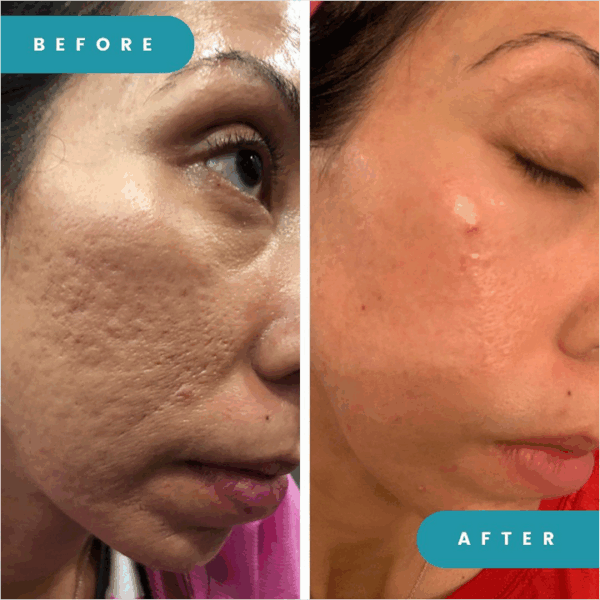 1beforeafter