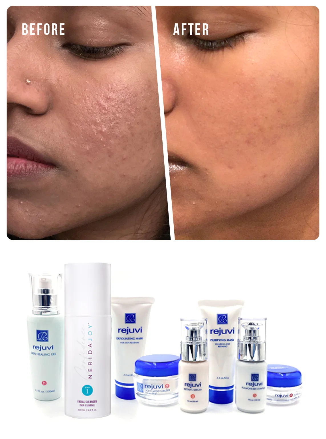 Oily Congested