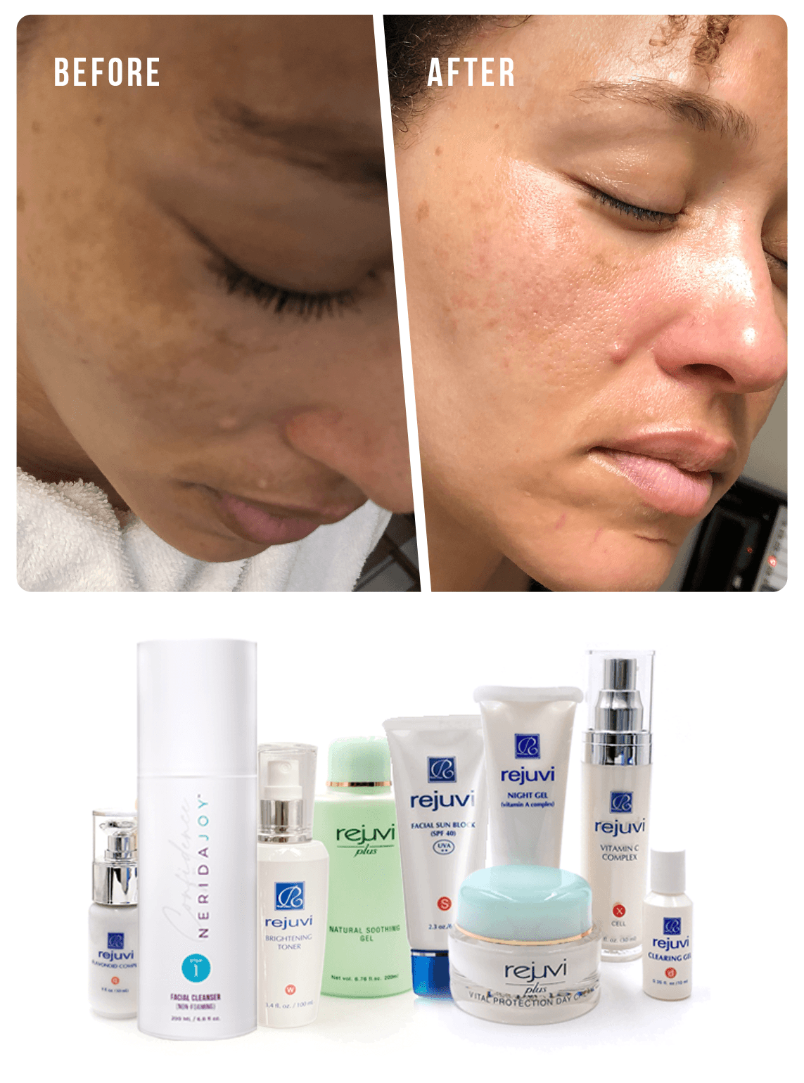 Pigmentation