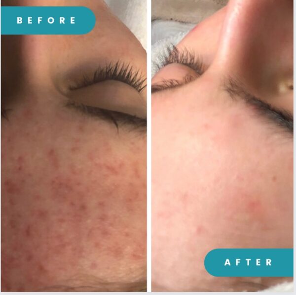 juliette-before-after