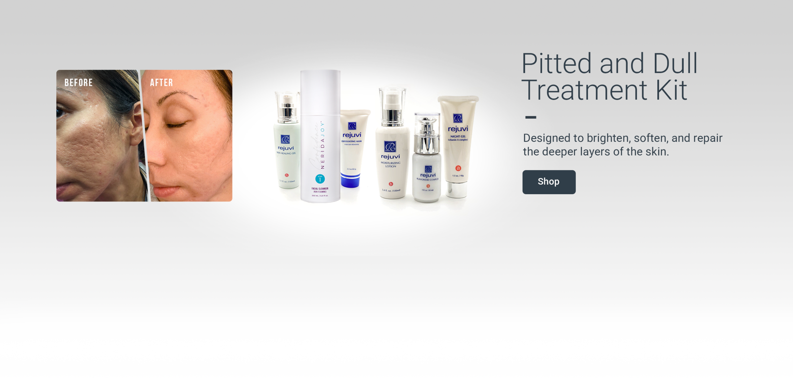 Pitted and Dull_Treatment_Desktop