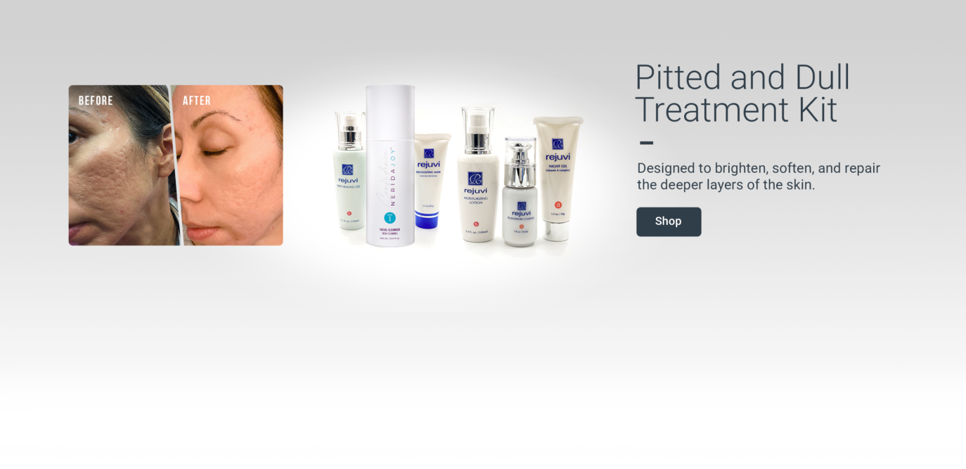 Pitted and Dull_Treatment_Desktop